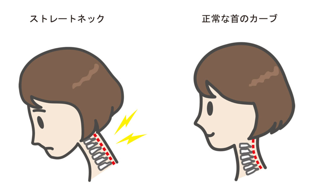 「ストレートネック」「IT眼症」をご存じですか？